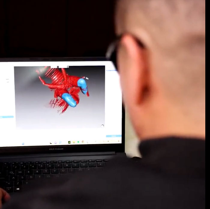 Exoprint 3D