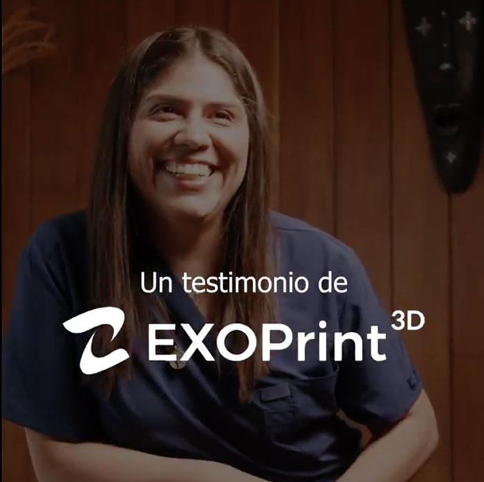 Exoprint 3D